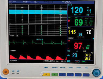医用监护仪有哪些主要系统