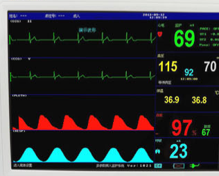 母亲胎儿监护仪的监测内容有哪些