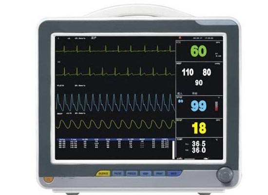 心电监护仪具有哪些鲜明特点