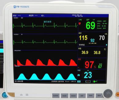 为什么需要使用中央监护系统？